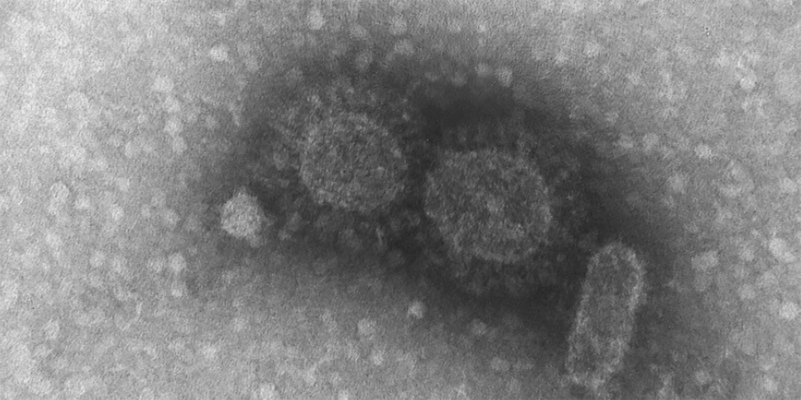 Privado: Maioria das doenças infecciosas tem origem em animais selvagens