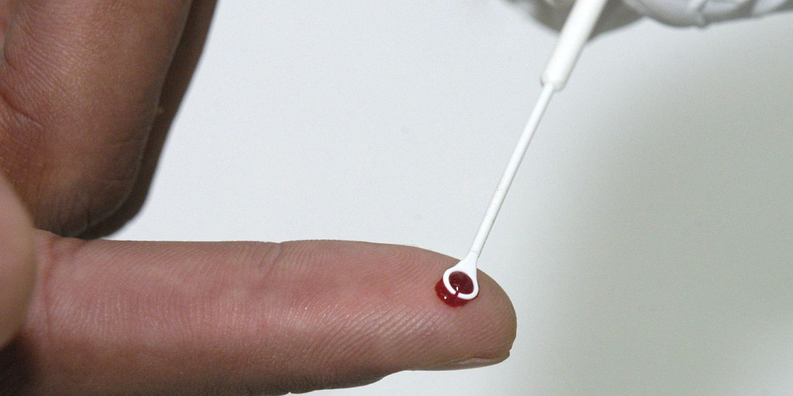 Privado: HIV: estudo mostra resistência de mutação a remédio usado no Brasil