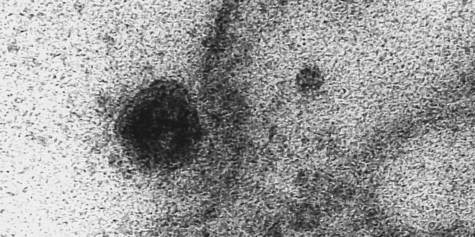 Privado: USP: novo coronavírus infecta e se replica em glândulas salivares