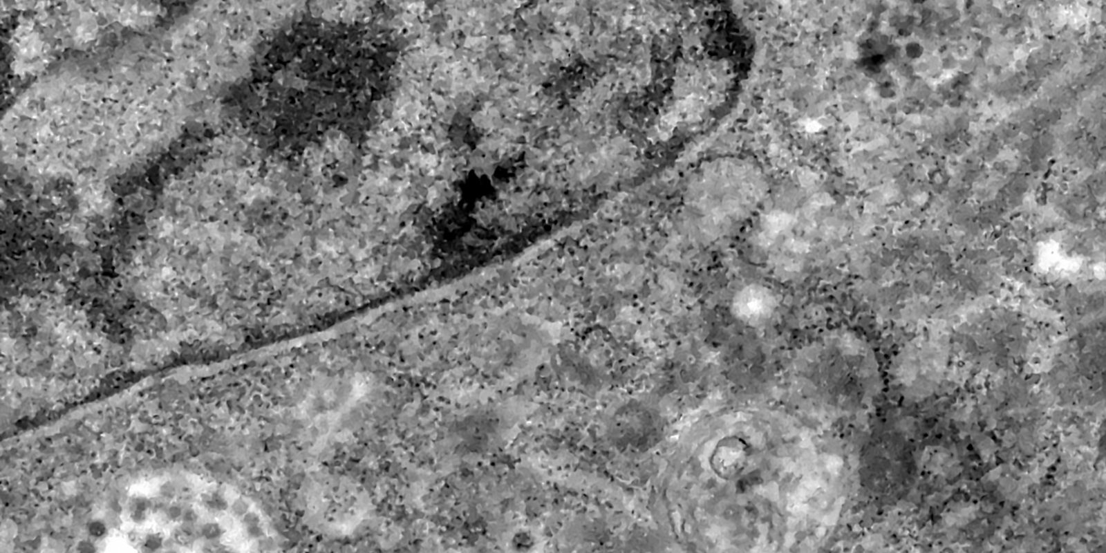 Privado: Pesquisa detecta coronavírus pela análise de retina