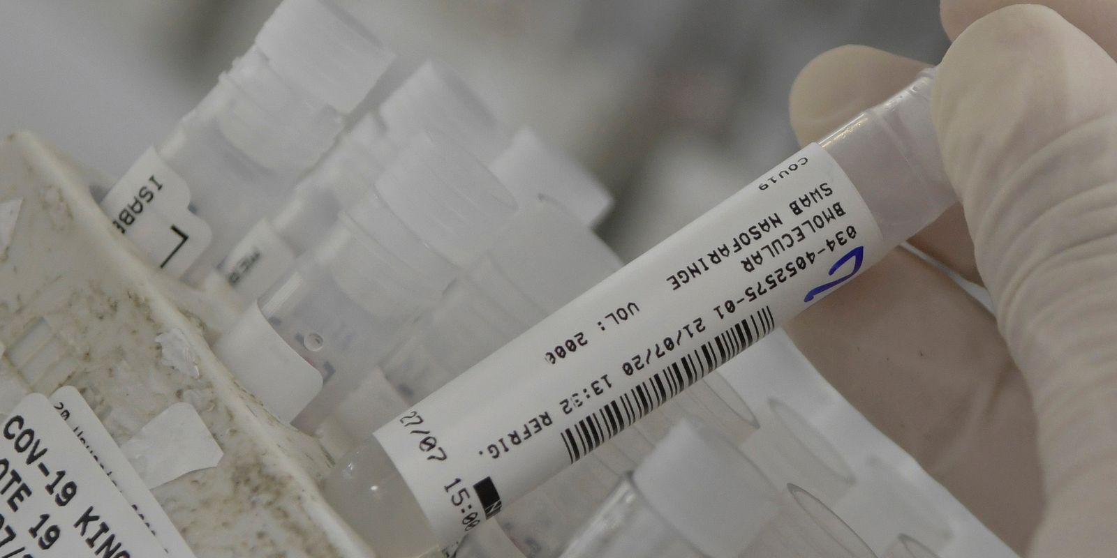 Privado: Covid-19: bebês de até 1 ano representam um terço das mortes infantis