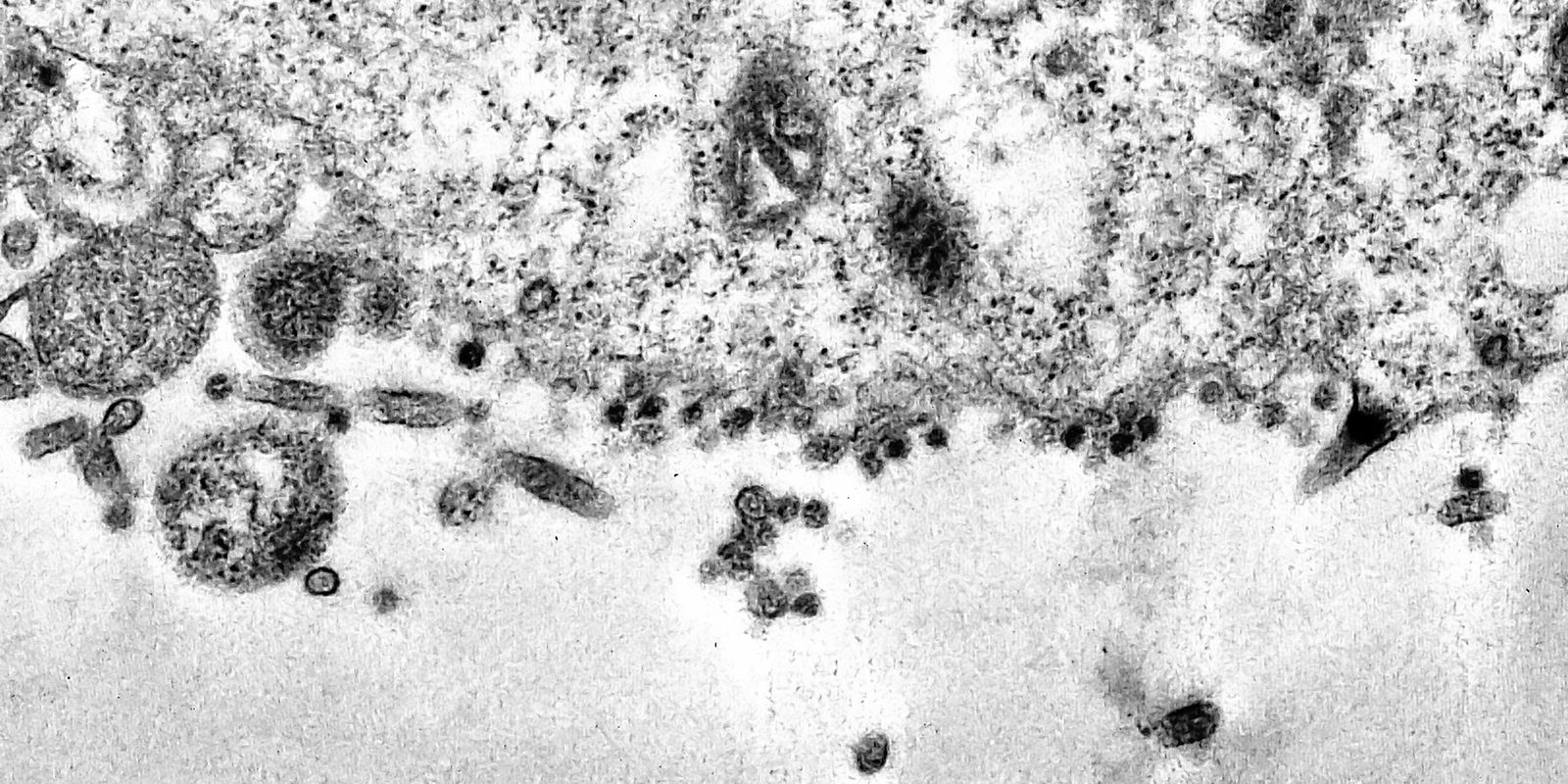 Privado: Pesquisadores da Unicamp criam modelo para prever mutações da covid-19