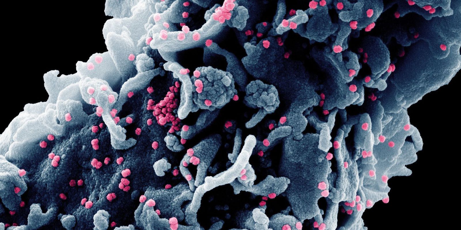 Privado: OMS anuncia grupo que estudará novos patógenos