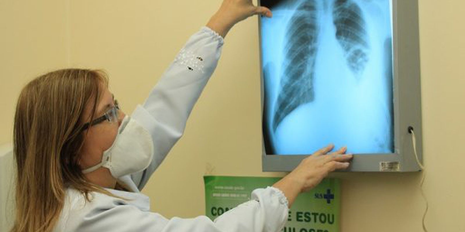 Privado: RJ, Acre e Amazonas lideram ranking de mortes por tuberculose no país