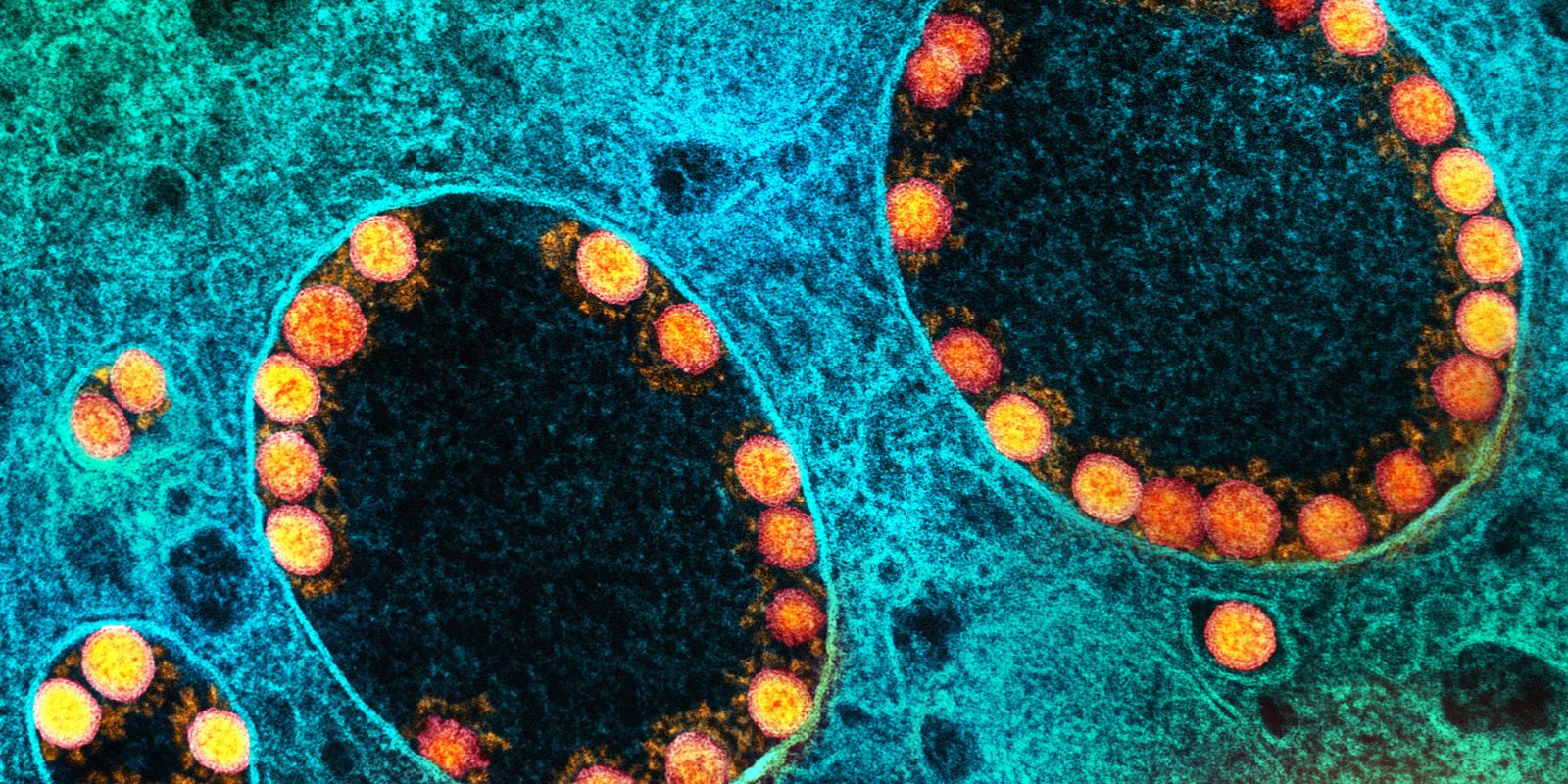 Privado: Aprovado o primeiro medicamento para tratamento da covid-19 no SUS