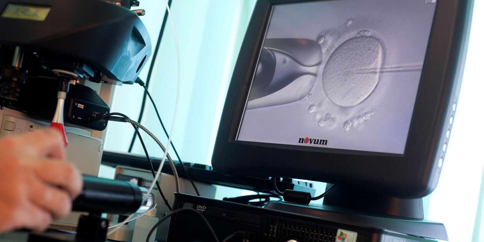 Privado: CFM já permite reprodução com material de casal do sexo masculino