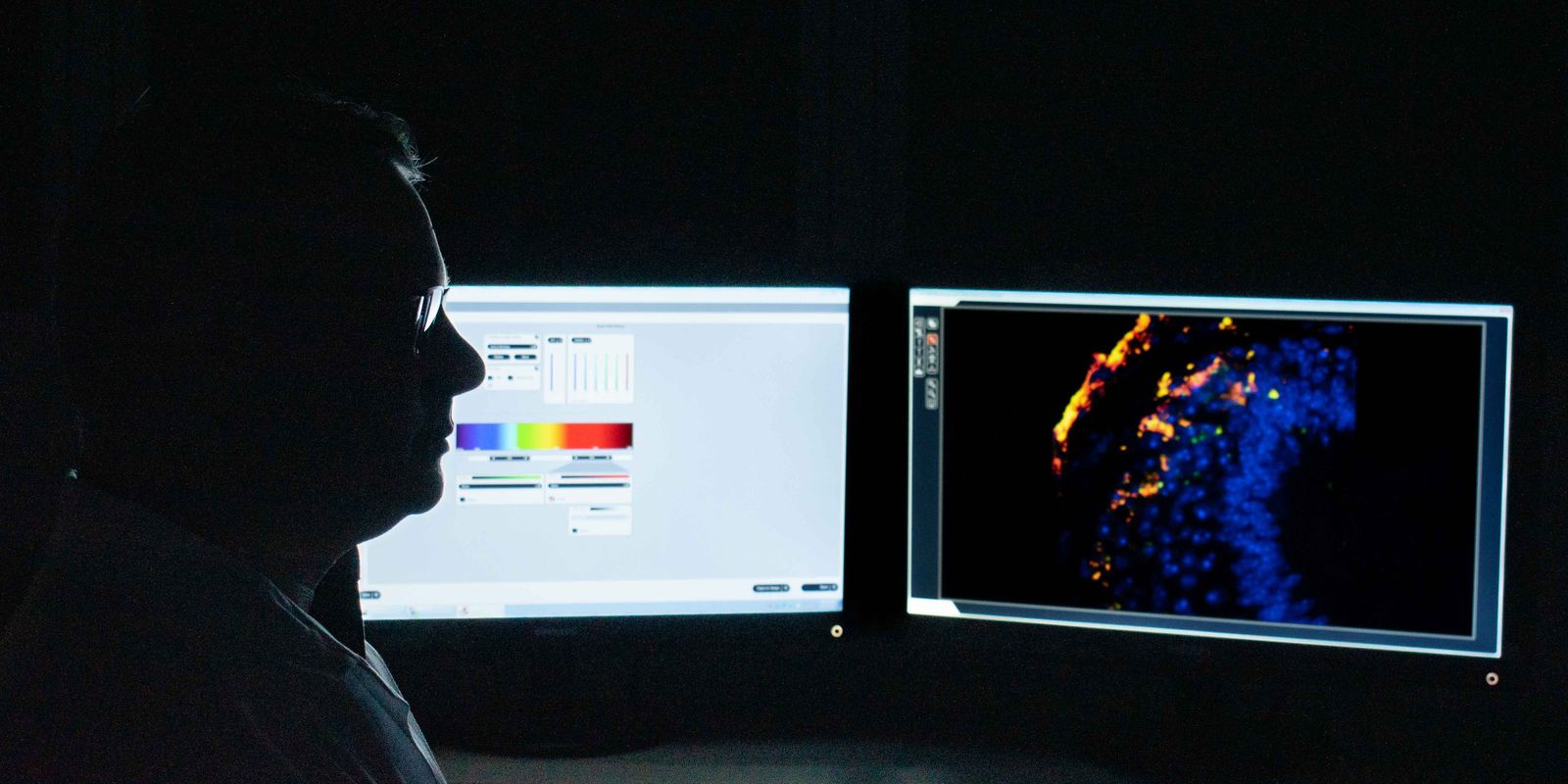 Privado: Estudo busca identificar tratamento gênico para Síndrome de Pitt-Hopki