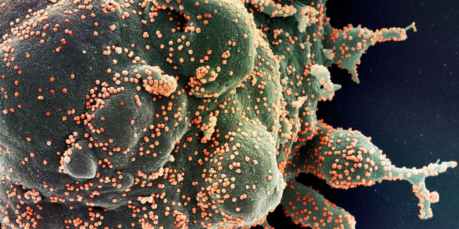 Privado: Covid-19: SP tem dois casos identificados da variante Ômicron XQ