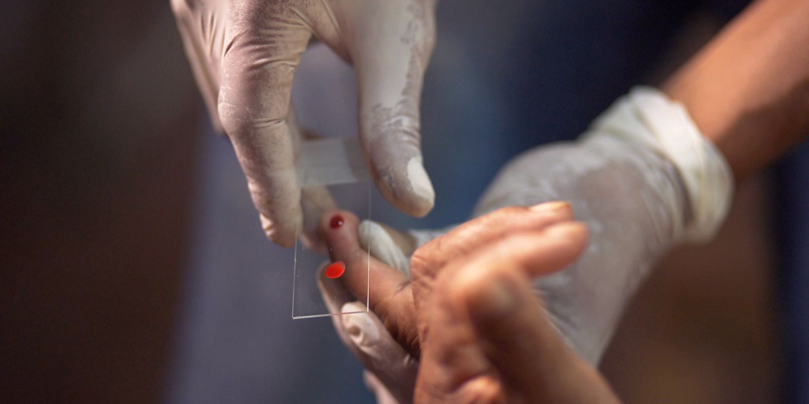 Privado: Ministério da Saúde quer zerar casos de malária no país até 2035