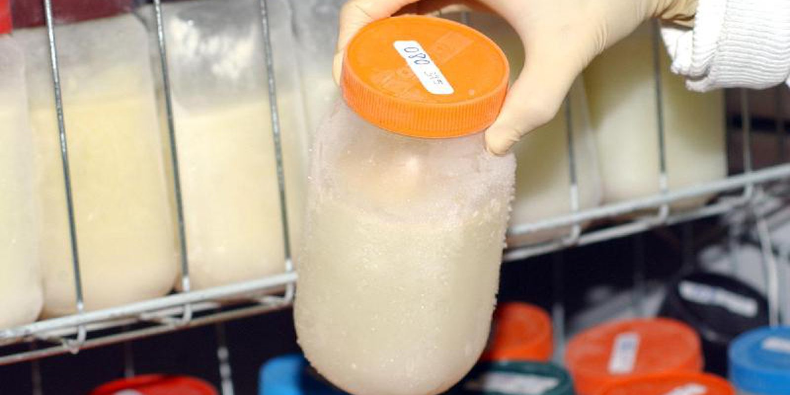 Privado: Doação de leite humano só atende metade da demanda no Brasil