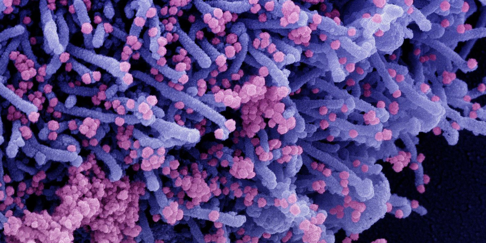 Privado: Mais de 98% dos paulistanos adultos têm anticorpos contra covid-19