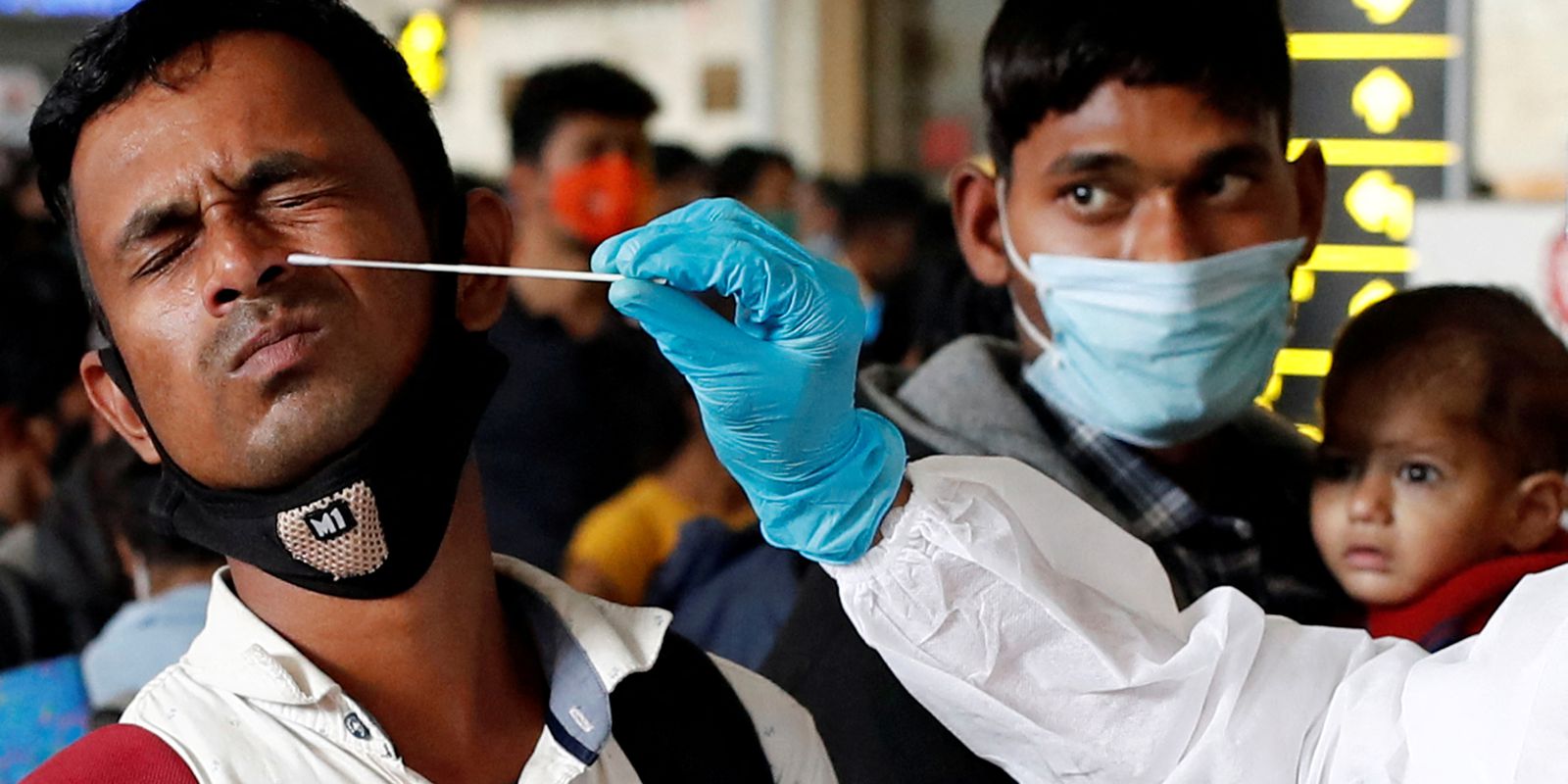 Privado: Covid-19 representa 41% dos casos de síndrome respiratória grave