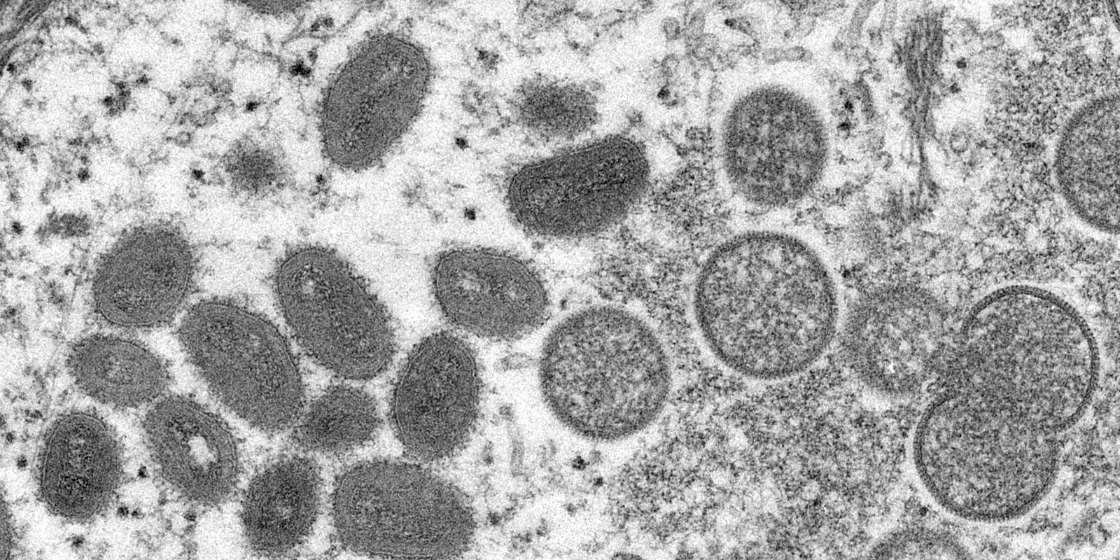 Privado: Macaé investiga suspeita de varíola dos macacos