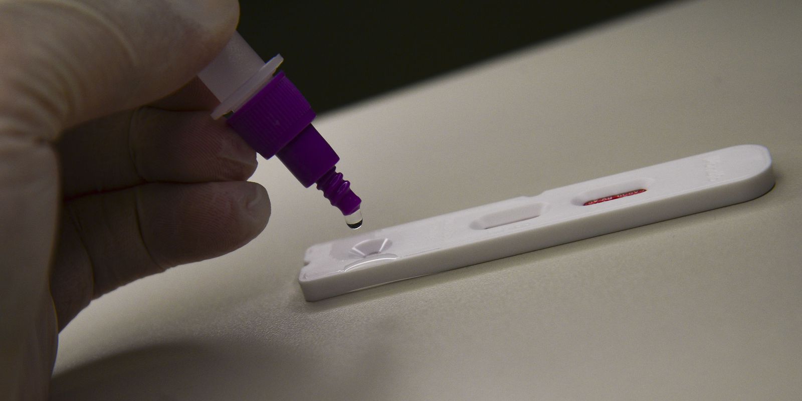 Privado: Fiocruz: casos de síndrome respiratória grave atingem patamar estável