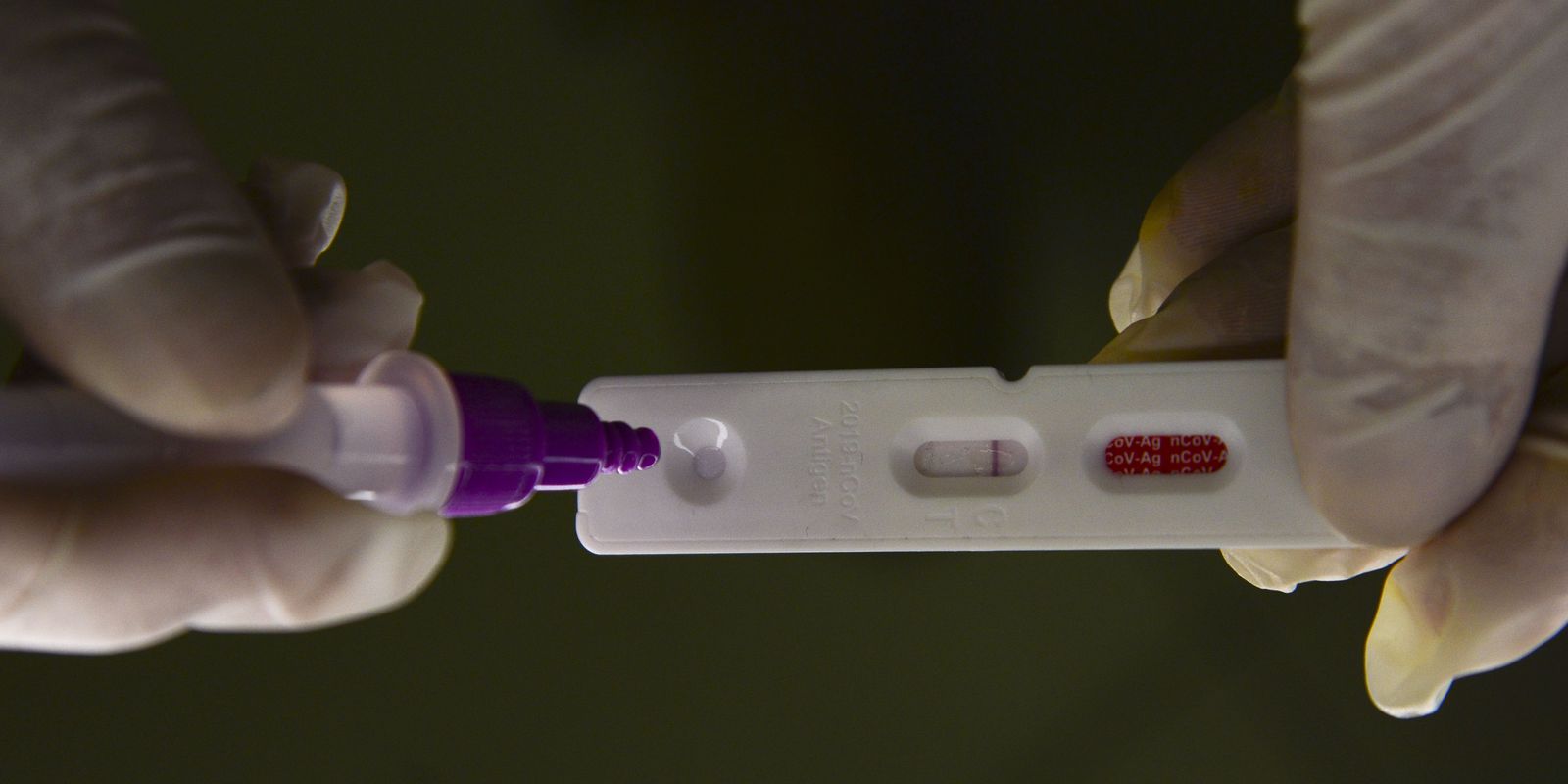 Privado: Covid-19: Brasil notifica 365 óbitos e 72 mil casos em 24 horas