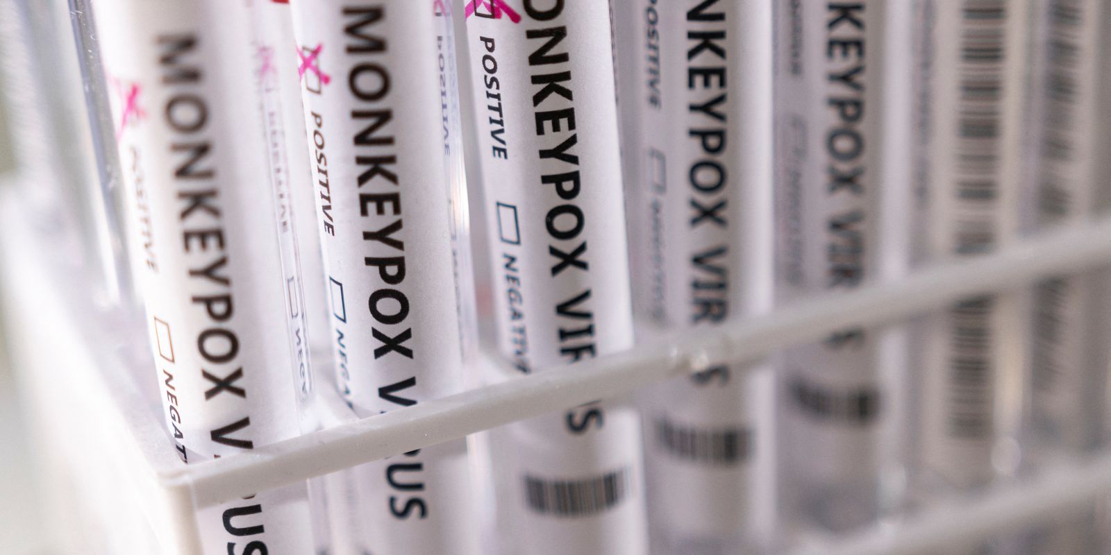 Privado: Brasil tem 17 casos confirmados para a varíola dos macacos