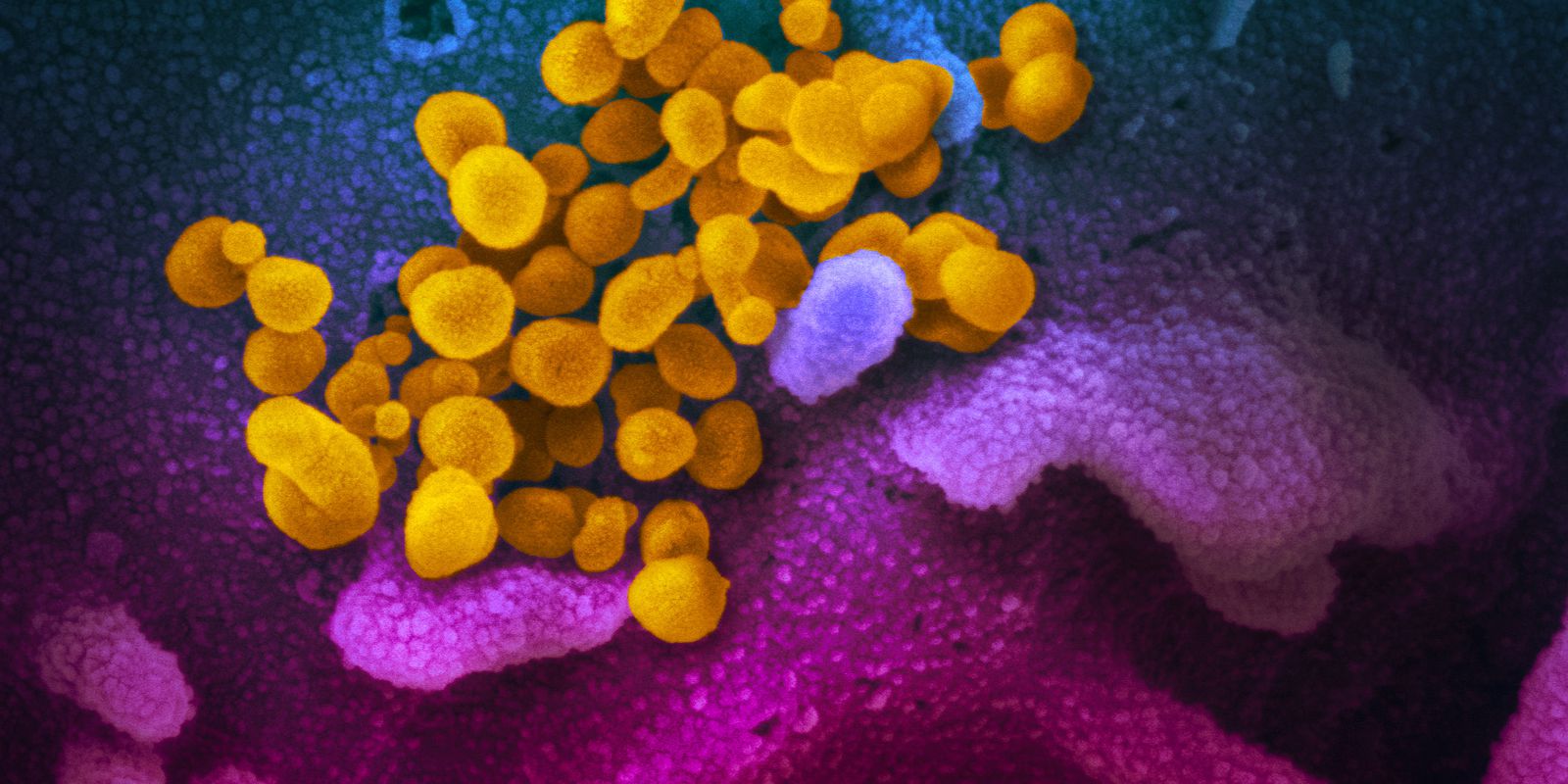 Privado: Covid-19: cenário epidemiológico no Rio apresenta estabilidade