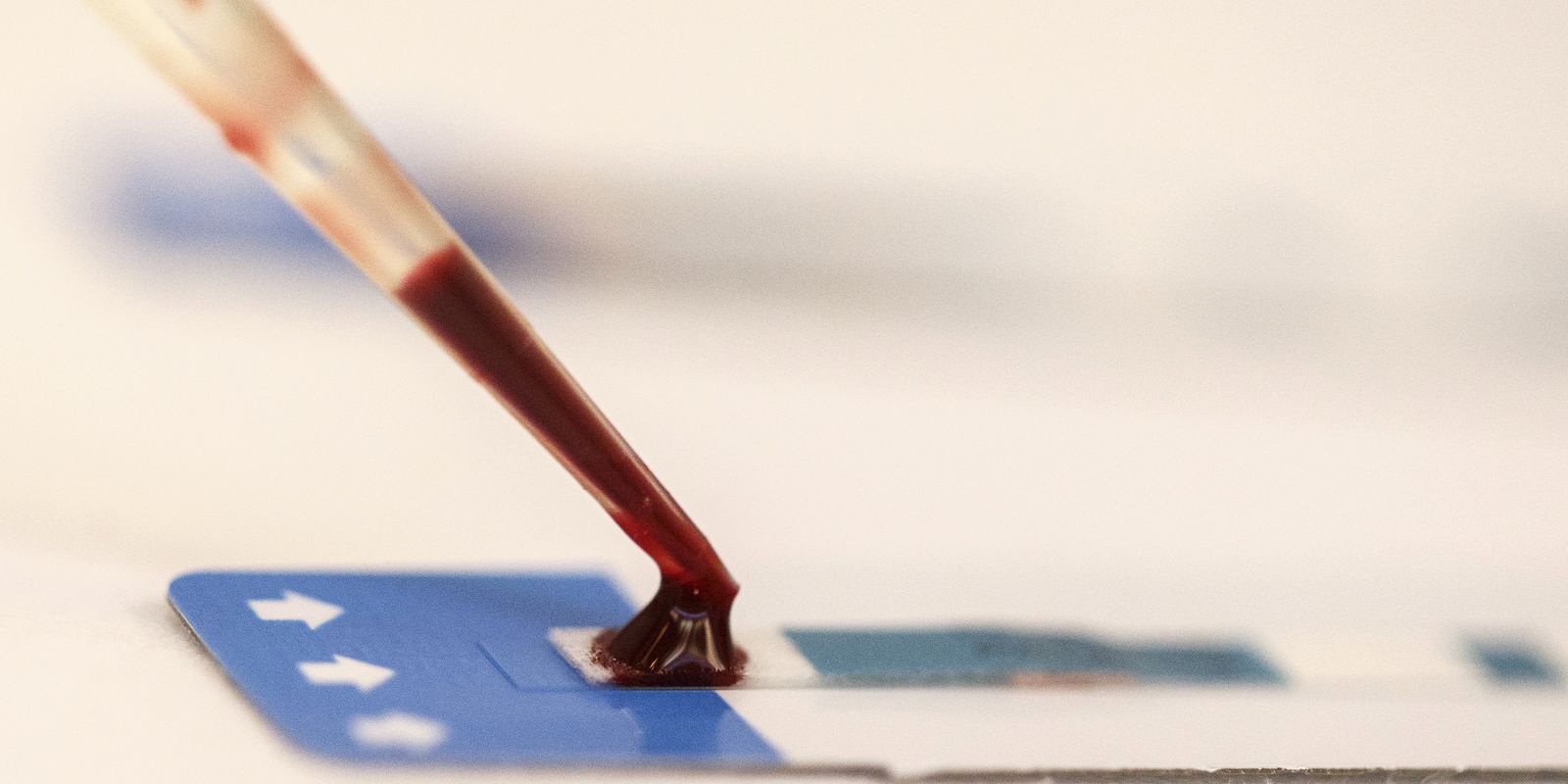 Privado: Paciente é declarado curado do HIV após receber células-tronco