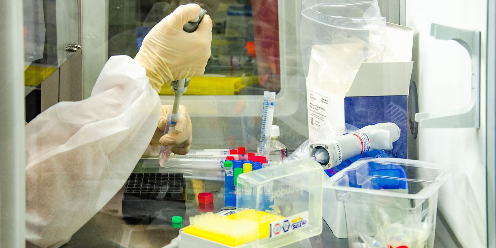 Privado: Fiocruz pede registro de dois testes moleculares para monkeypox