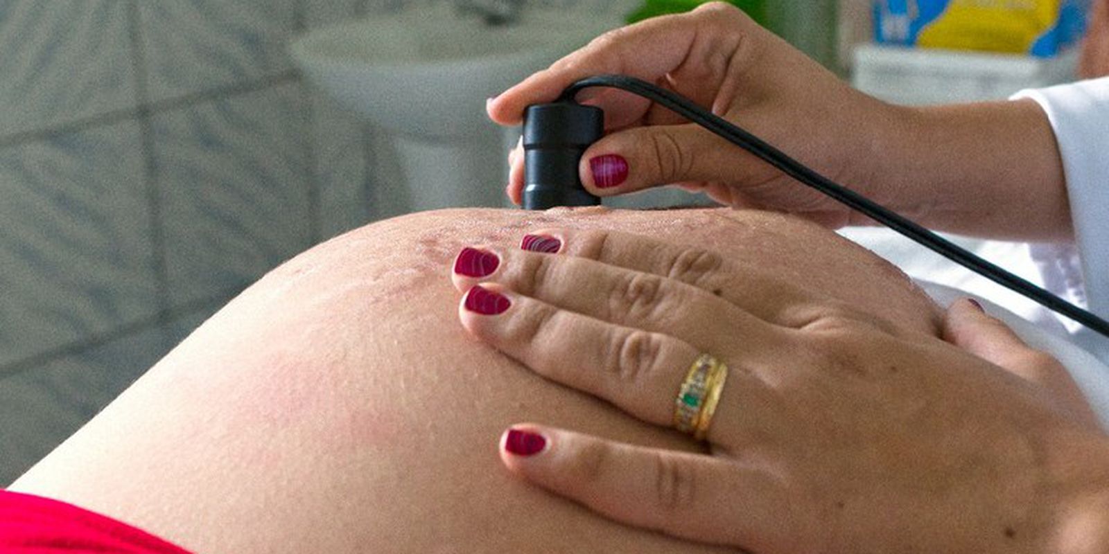 Privado: Entidade alerta para risco de diabetes em gestantes