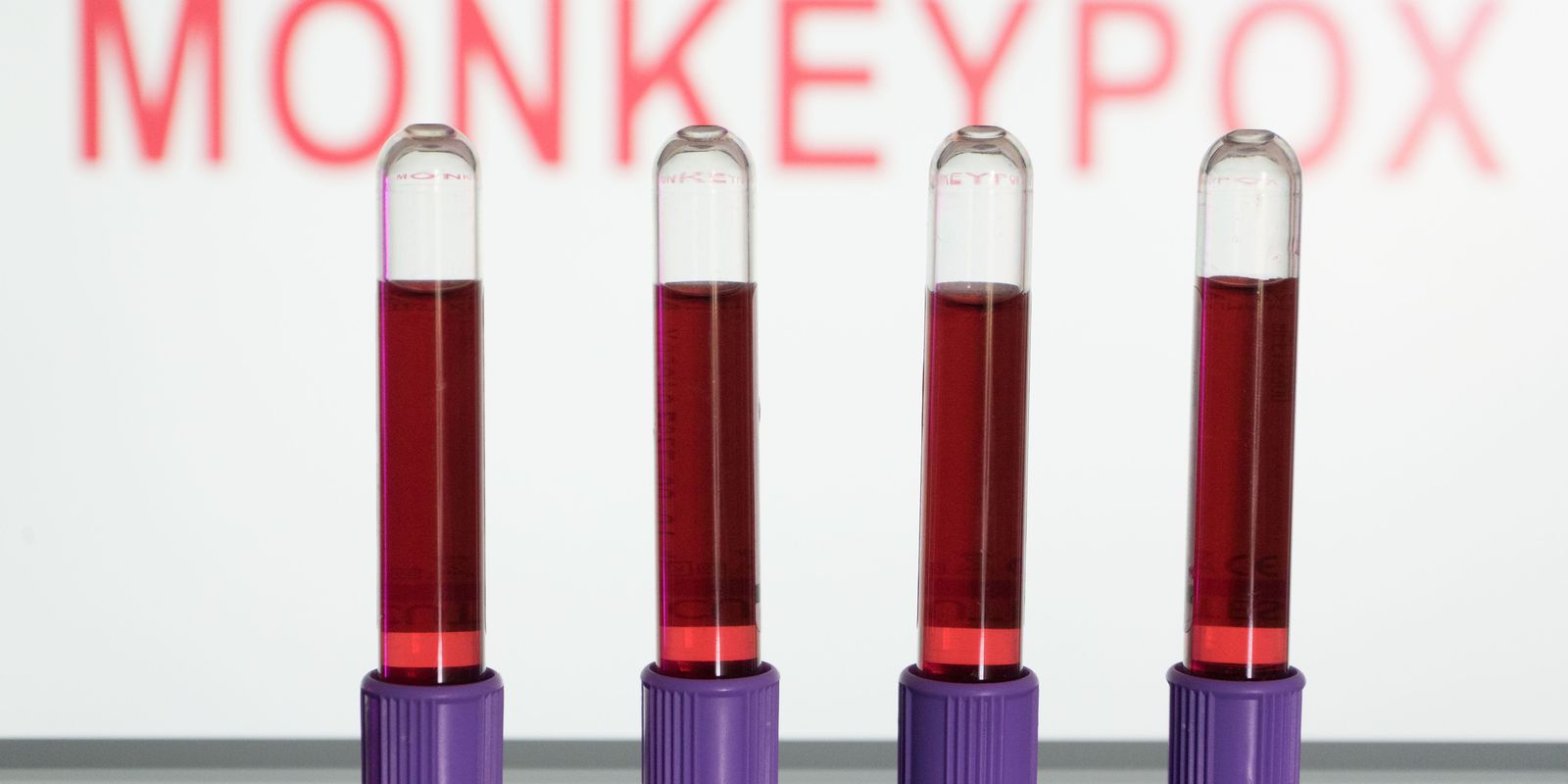 Privado: Anvisa autoriza uso emergencial de kits para varíola dos macacos