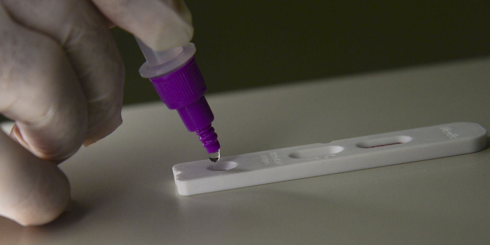 Privado: Brasil registra 38 mortes e 5,3 mil novos casos de covid-19