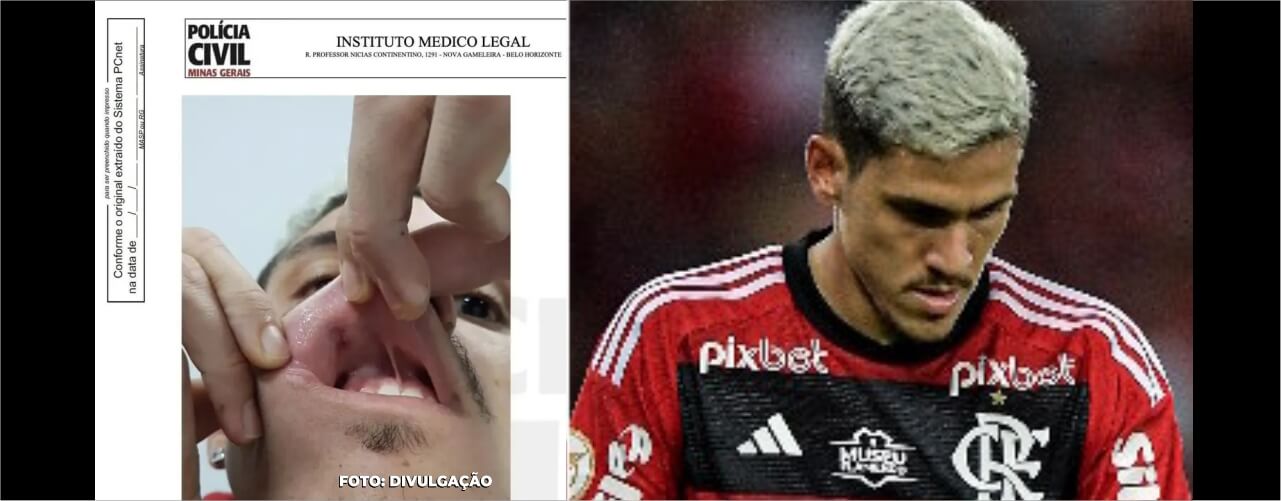 confronto entre Flamengo e Atlético-MG, onde Pedro se recusou a seguir com o aquecimento