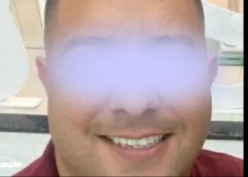 Homem perde parte do pênis após mordida da companheira