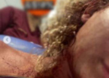 Mulher denuncia agressão em Rocha Miranda após recusar investida em festa na Zona Norte