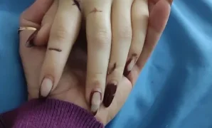 Jovem Sobrevive a 15 Facadas após Recusar Relacionamento; Primeira Audiência Marcada