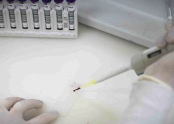 Paciente internado em São Paulo testa negativo para ebola; exames confirmam meningite