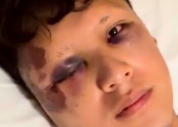Turista mexicano é agredido e roubado em Copacabana; Polícia Civil investiga